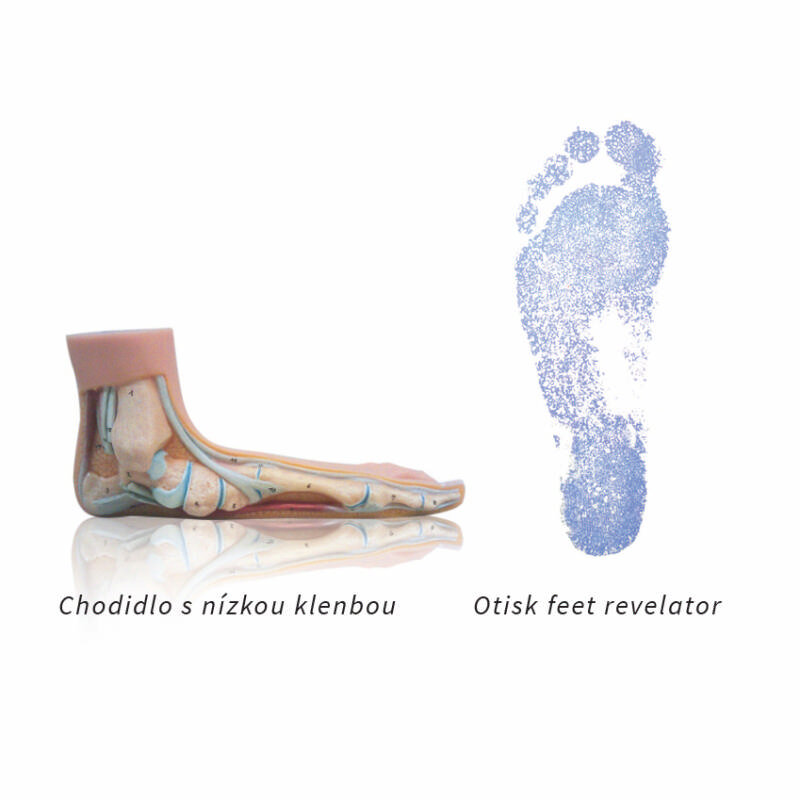 Vložky Sidas 3Feet Comfort CZ